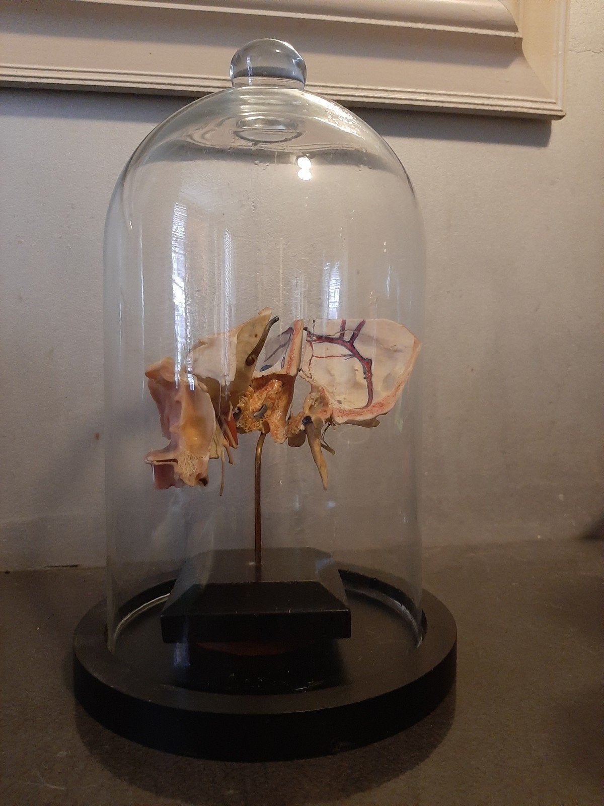 anatomisch model menselijk hoofd., Ophalen of Verzenden