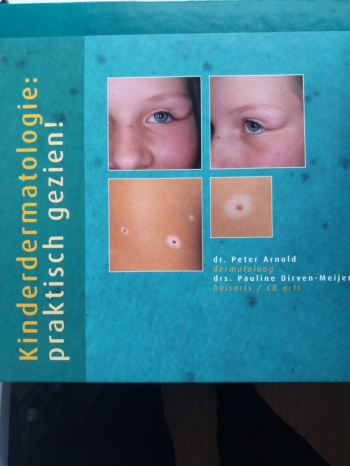 Kinderdermatologie: praktisch gezien! - Dr. Peter Arnold, Ophalen of Verzenden, Zo goed als nieuw, Ziekte en Allergie, Dr. Peter Arnold, Drs. Pauline Dirven-Meijer