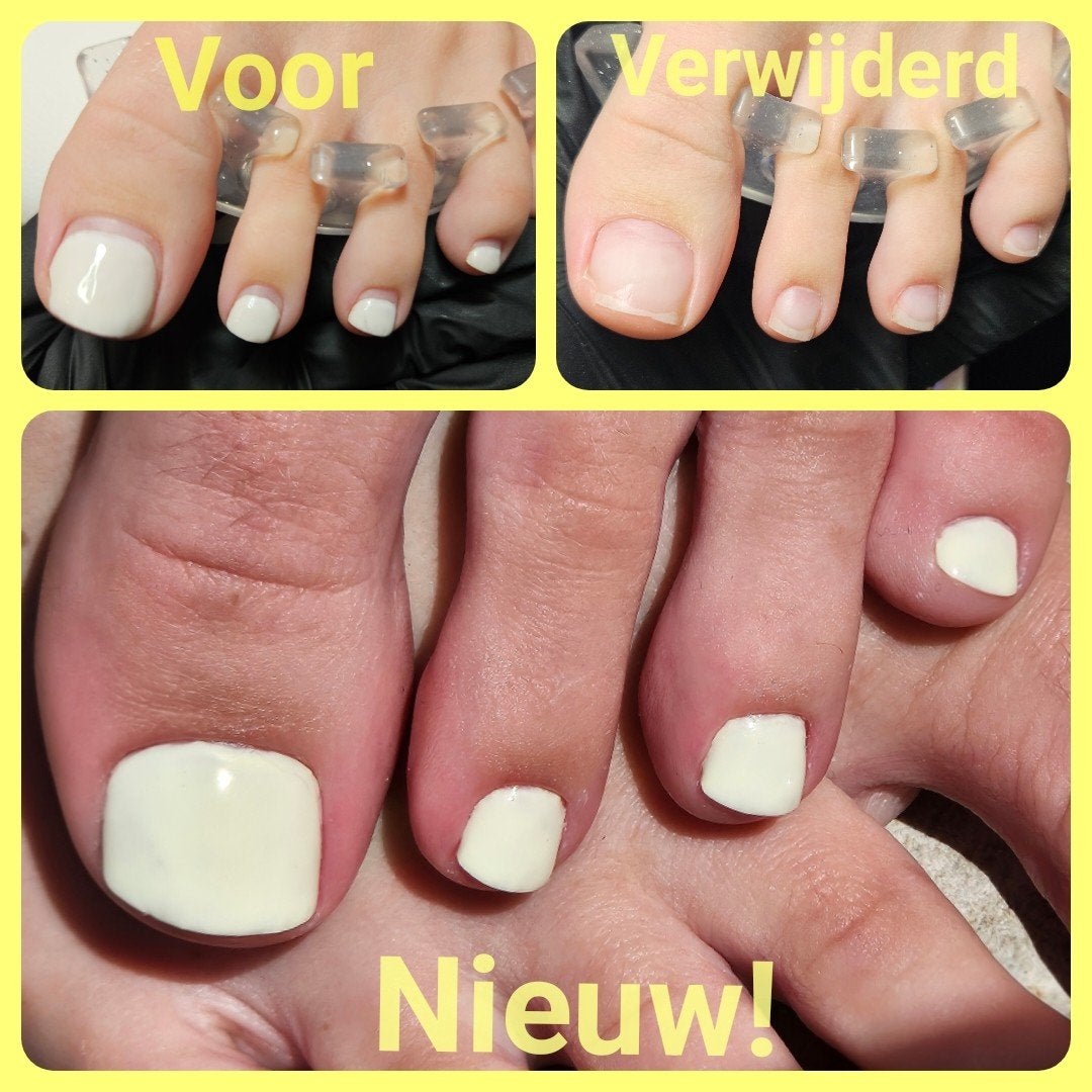 Gelpolish op teennagels(voeten), Ophalen, Nieuw, Handen en Nagels