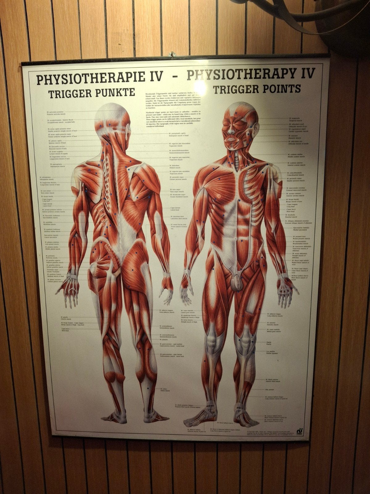 Fysiotherapie Anatomie Poster - Triggerpunten, Gebruikt, Meerkleurig, Overige stijlen, Ophalen of Verzenden