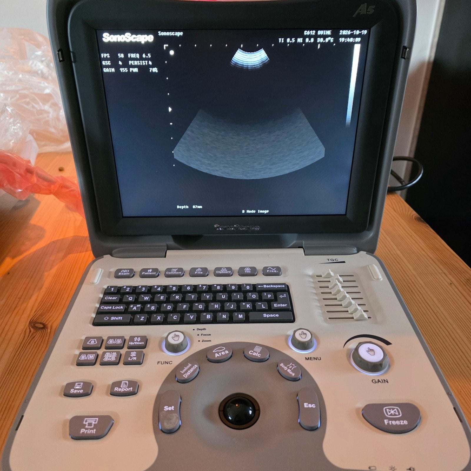 SonoScape A5 Draagbaar Ultrasoonapparaat met C612 Probe, Ophalen