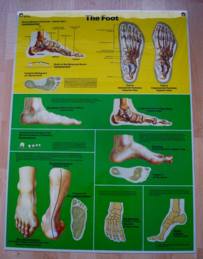 Anatomie van de Voet poster, Ophalen, Zo goed als nieuw