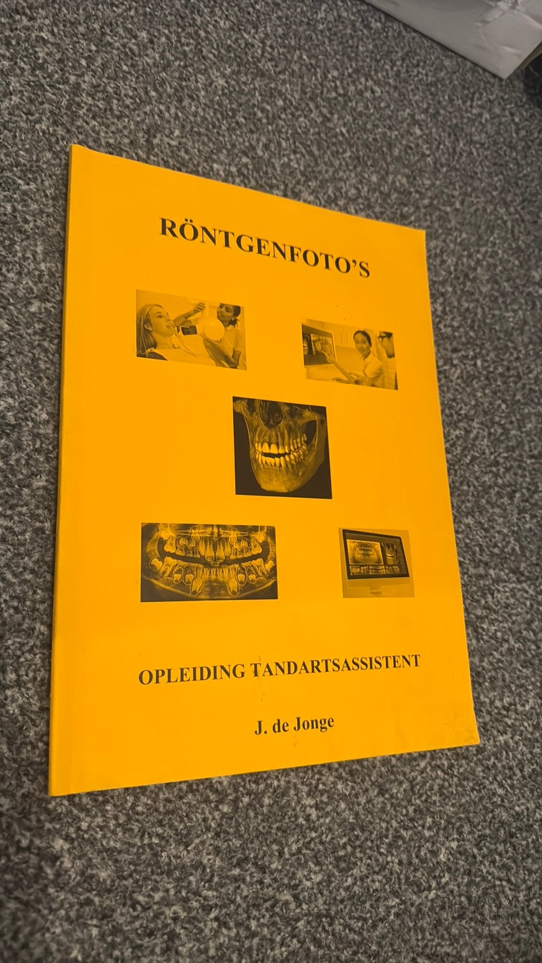 J. de Jonge - Röntgenfoto's, Ophalen of Verzenden, Zo goed als nieuw, J. de Jonge