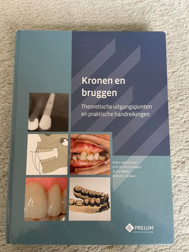 Kronen en bruggen: Theoretische uitgangspunten en praktische, Boeken, Ophalen, Beta, Zo goed als nieuw, WO