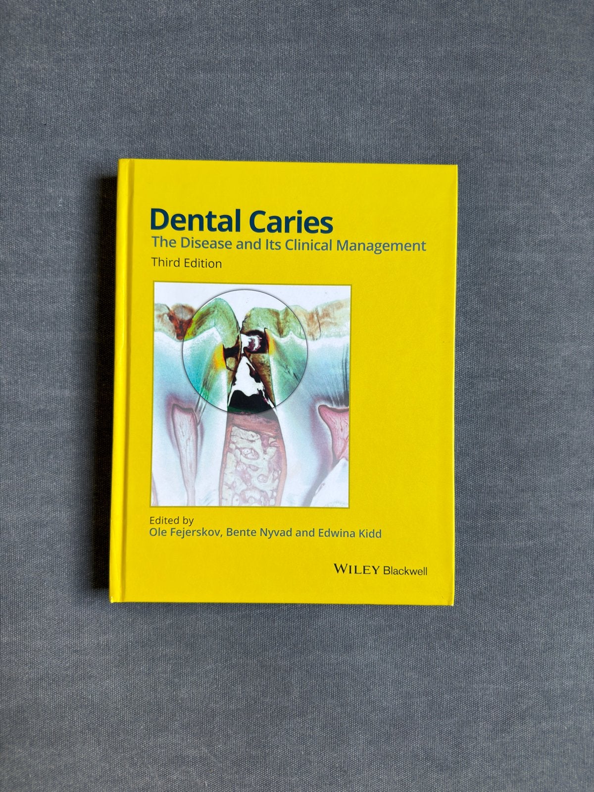 Dental Caries 3e editie, Boeken, Ophalen of Verzenden, Beta, Nieuw, HBO
