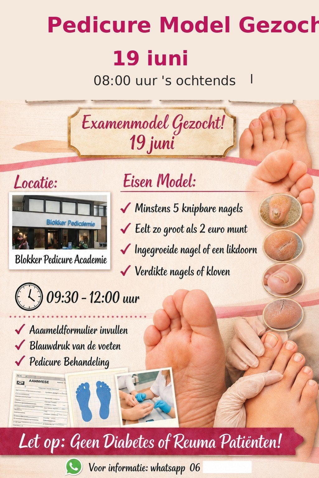 Gratis peducure behandeling,  hoorn plus vergoeding, Ophalen of Verzenden
