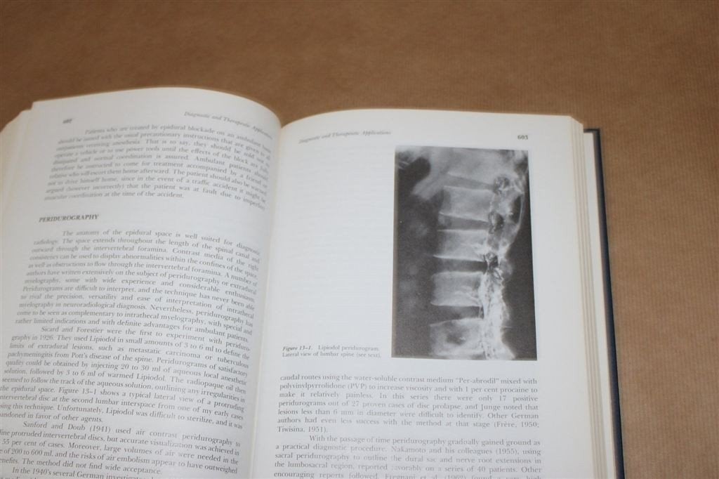 Epidural analgesia. Bromage., Ophalen of Verzenden, Gelezen