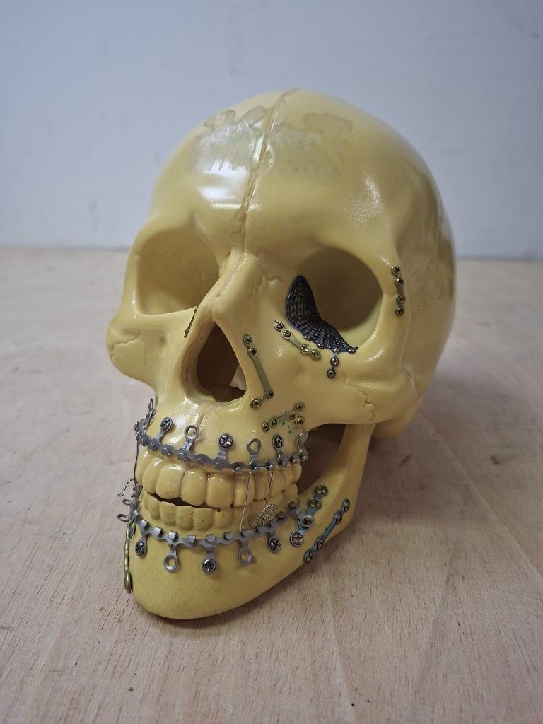 Medisch craniotomie schedelmodel met titanium plaatjes, Ophalen of Verzenden, Gebruikt