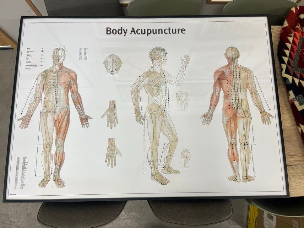 Acupunctuur Wandkaart ingelijst- Gedetailleerde Anatomie, Ophalen, Duitsland, Meerkleurig, Overige stijlen