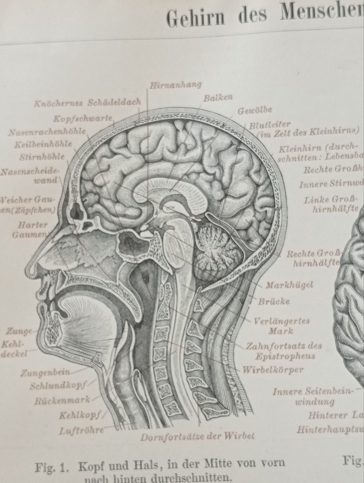 Anatomische Medische Gravure Gehoor & Hersenen 1895, Ophalen of Verzenden