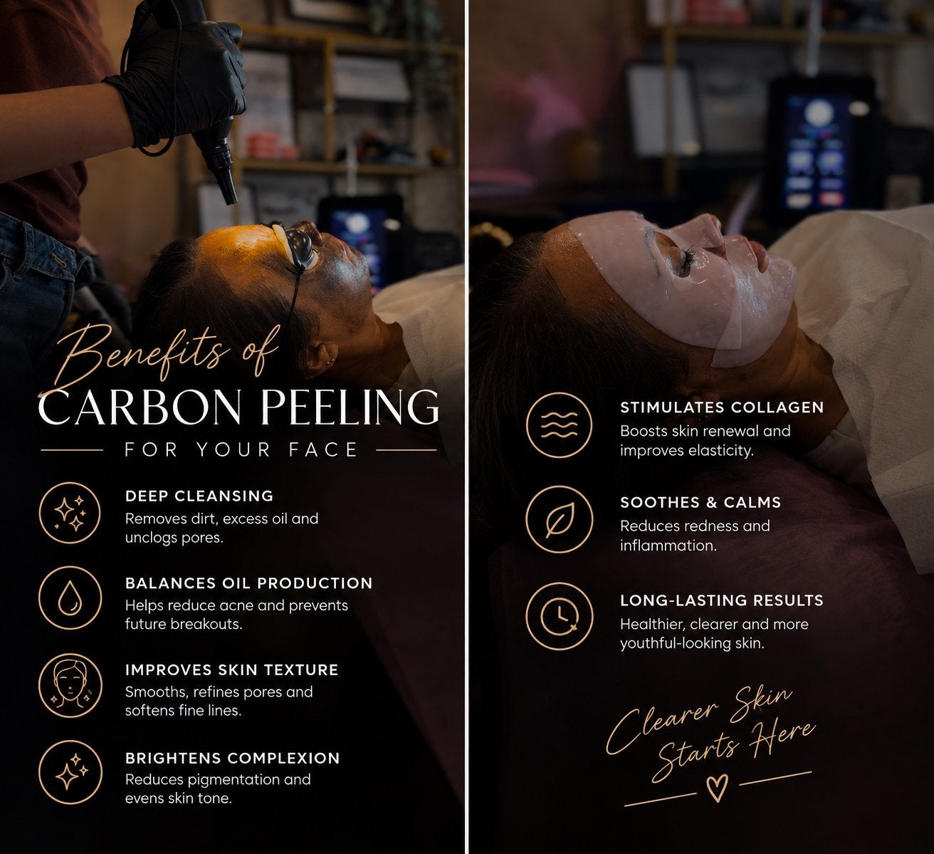 ND:YAG Laser – Carbon Peeling, PMU & Tattoo Verwijderen, Komt aan huis, Huidbehandeling