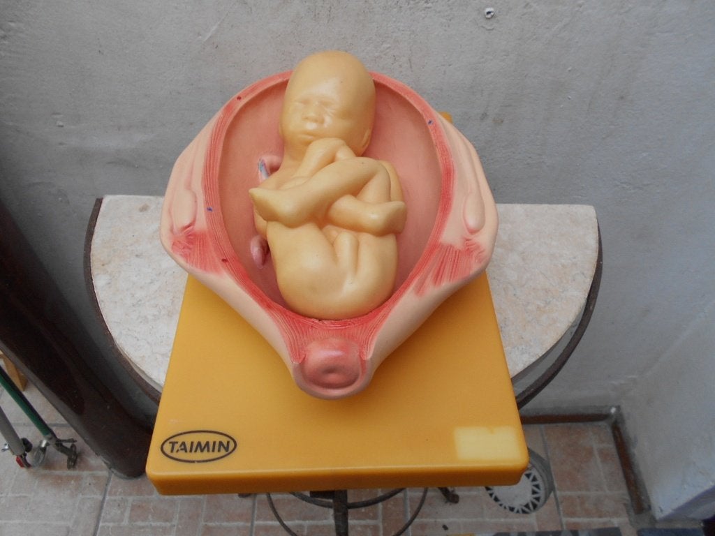 anatomie-foutus in baarmoeder-didactisch  1970, Ophalen of Verzenden, Beta, Zo goed als nieuw, MBO