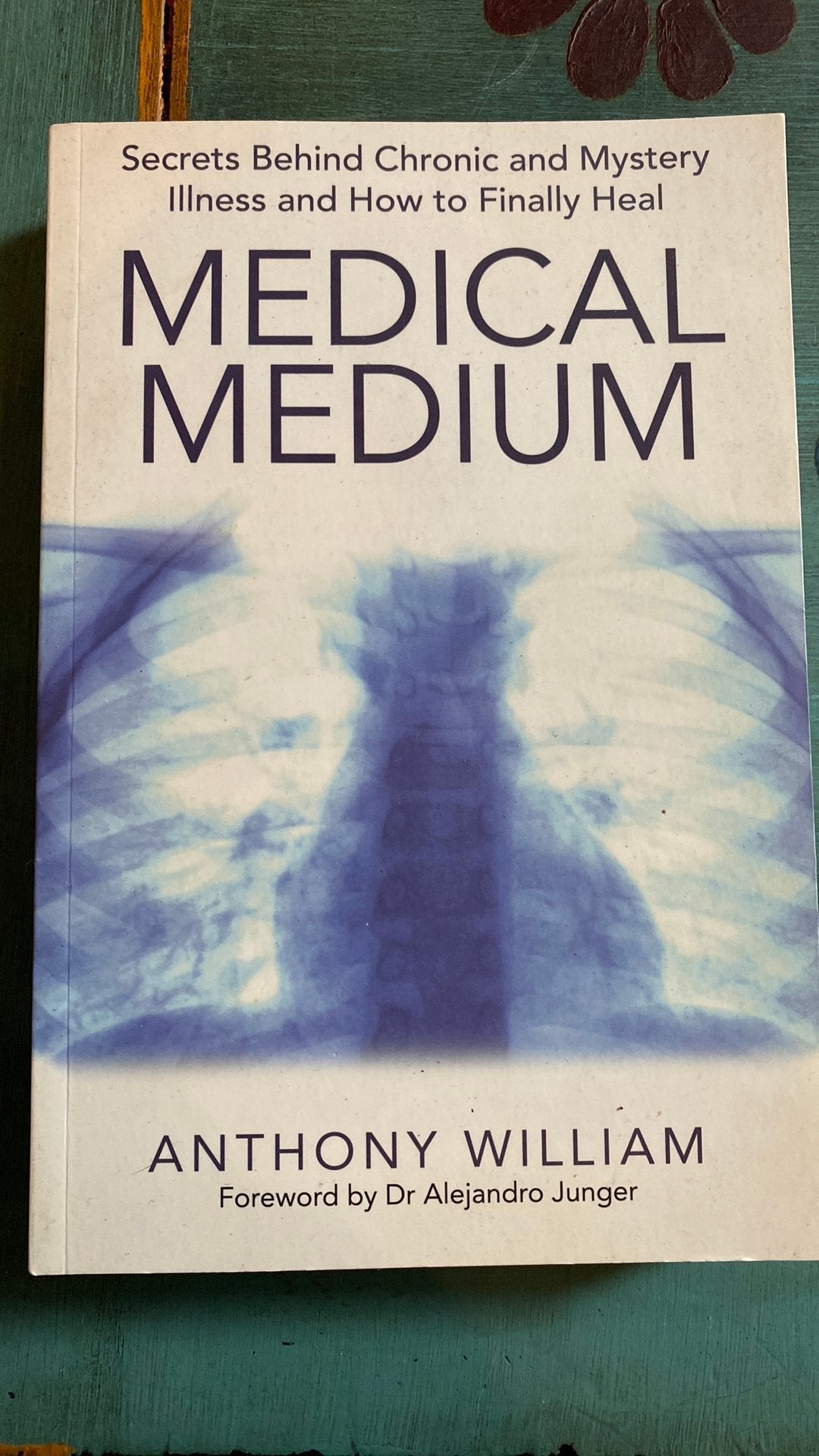 Medical Medium van Anthony William, Boeken, Ophalen, Zo goed als nieuw