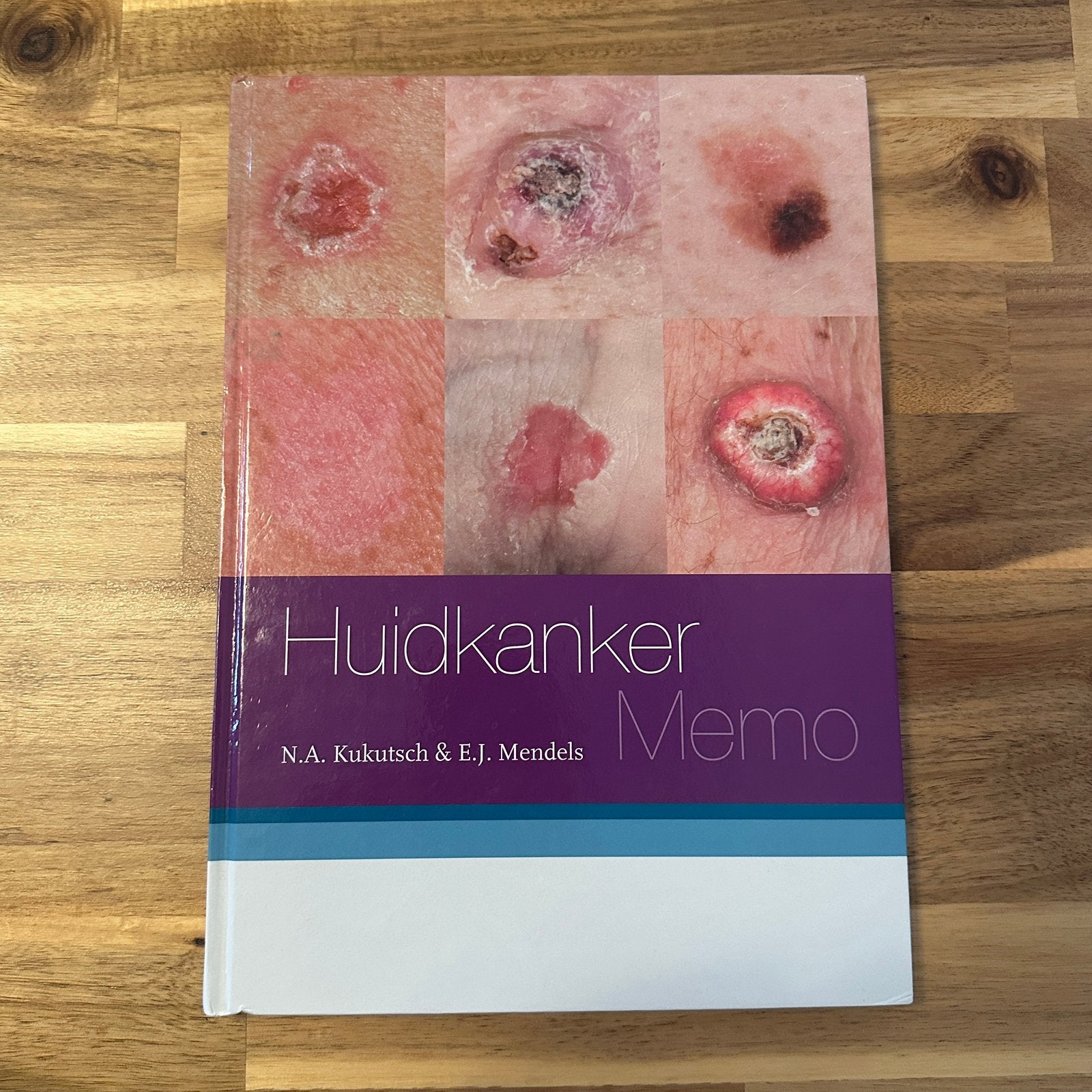 Huidkanker Memo – 2e herziene druk (2018), Ophalen, Zo goed als nieuw