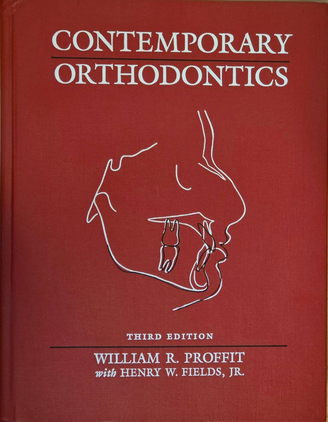 Contemporary Orthodontics - William R. Proffit, Ophalen, William R. Proffit, Beta, WO