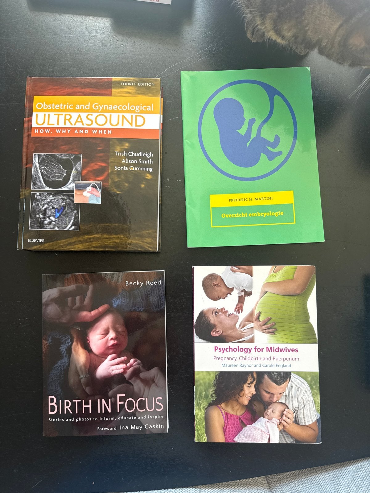 Boeken over verloskunde, gynaecologie en embryologie, Ophalen of Verzenden, Beta, Gelezen, HBO