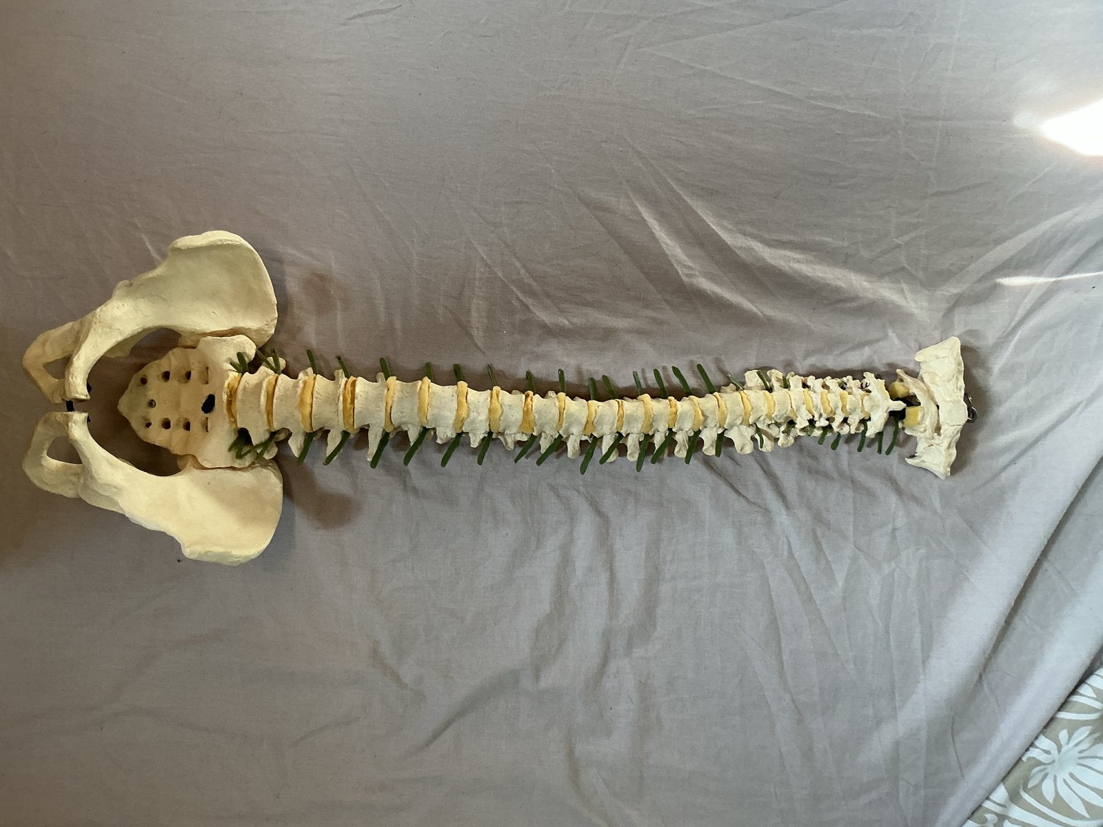 Anatomisch wervelkom van  mannelijke bekken , levensgroot, Ophalen of Verzenden, Gebruikt