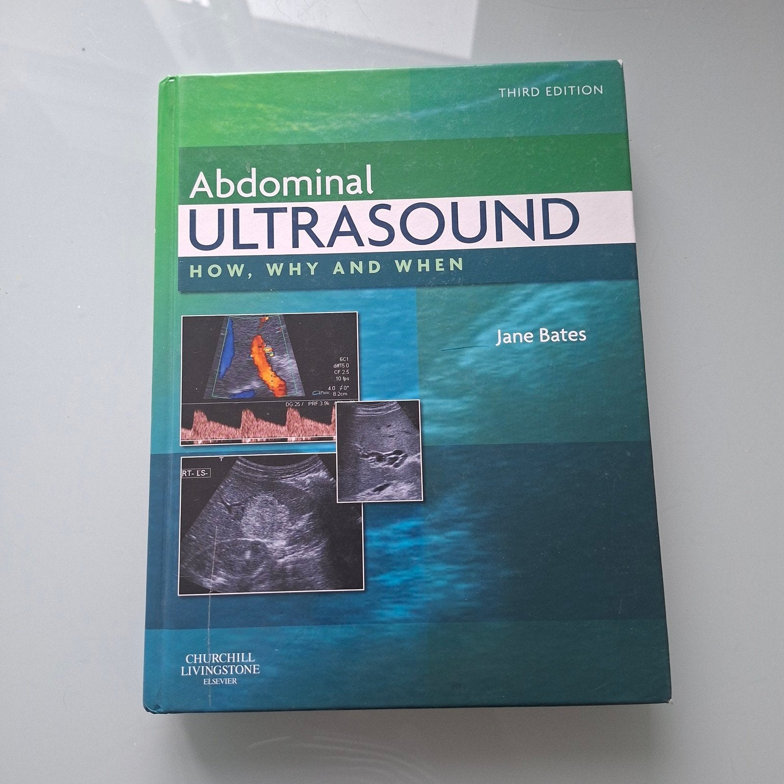 Abdominal Ultrasound: How, Why and When - Jane Bates, Boeken, Jane Bates, Zo goed als nieuw, Beta, HBO