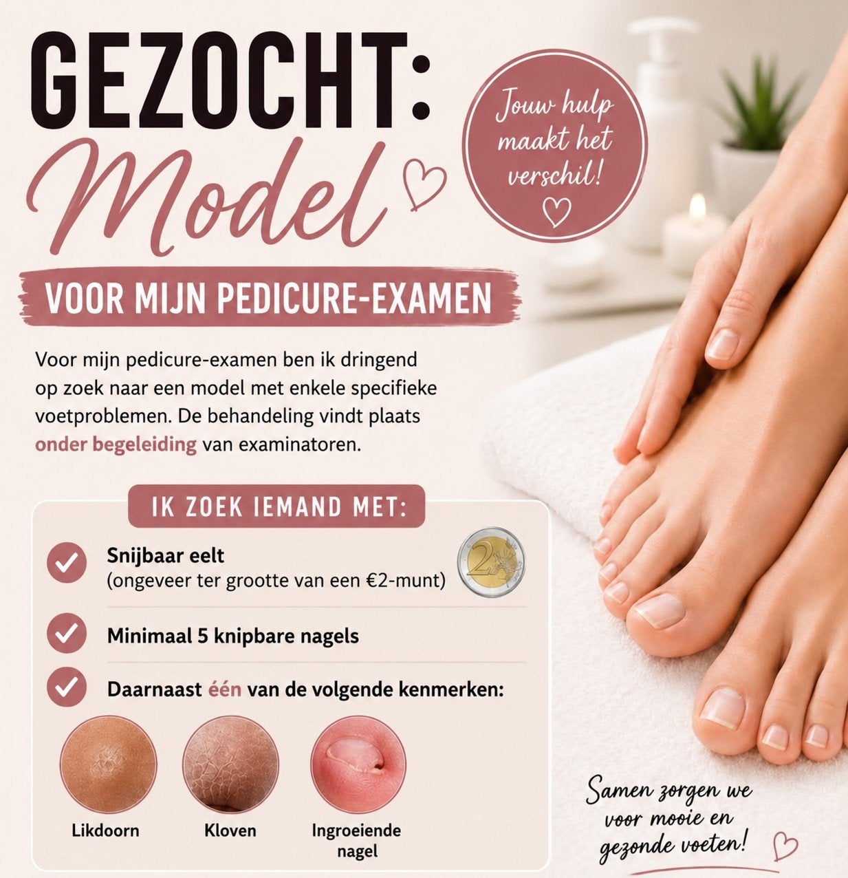 Examen model pedicure, Ophalen, Overige typen