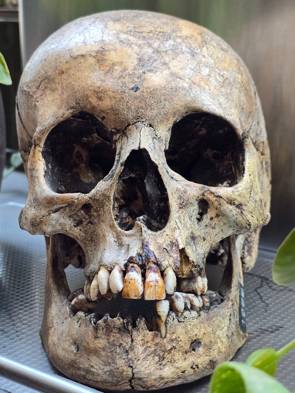 Pathologische schedel mens, Ophalen of Verzenden