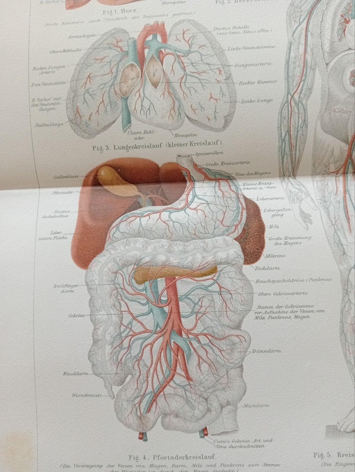 Anatomische Medische Litho 1895 Bloedvaten, Ophalen of Verzenden, Voor 1940, Gebruikt