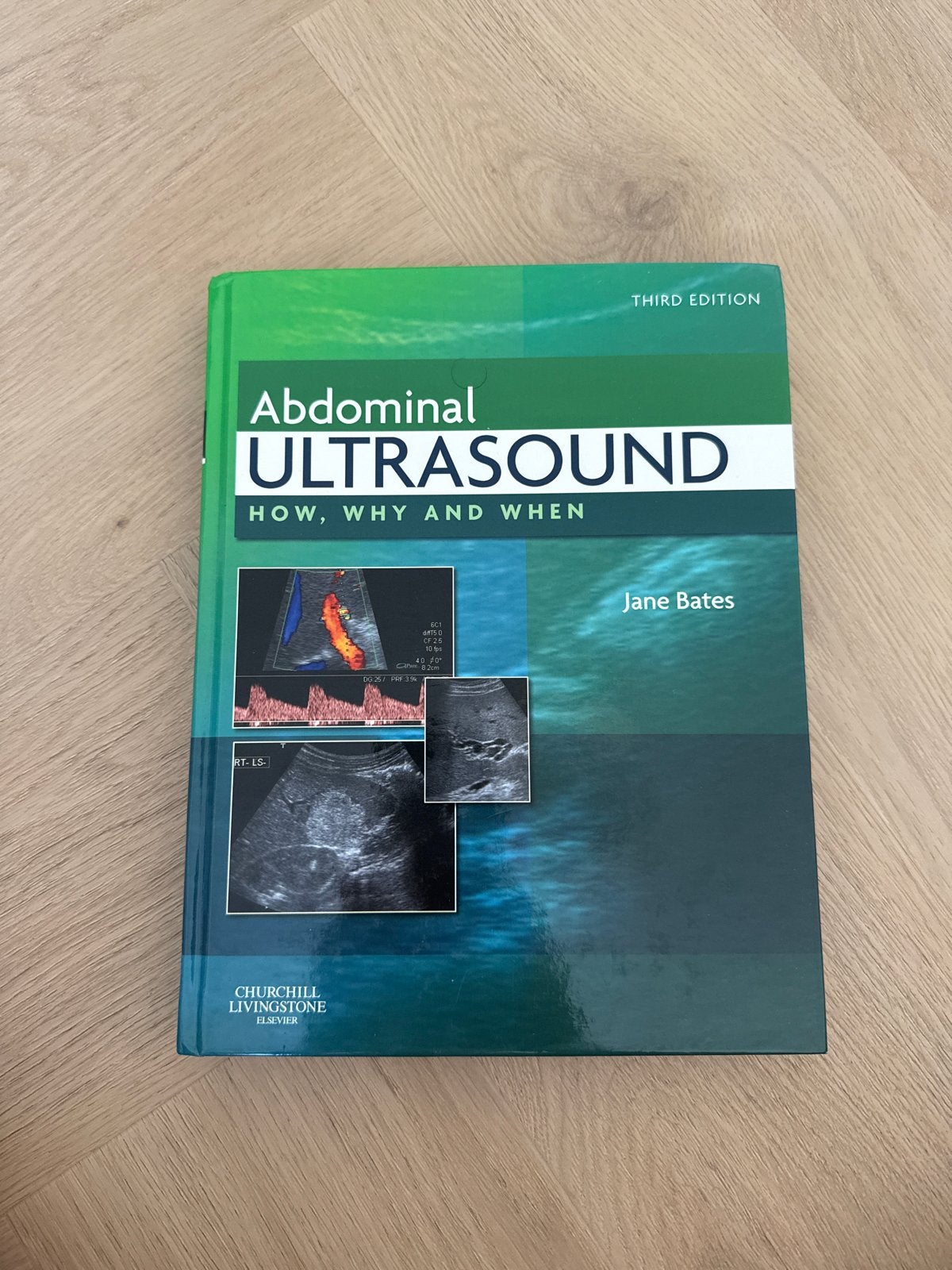 Abdominal Ultrasound: How, Why and When - Jane Bates, Boeken, Ophalen of Verzenden, Beta, Nieuw, HBO
