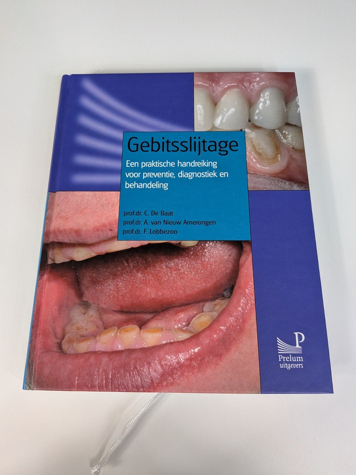 A. van Nieuw Amerongen - Gebitsslijtage, Gelezen, Sociale wetenschap, A. van Nieuw Amerongen; C. de Baat; F. Lobbezoo, Ophalen of Verzenden