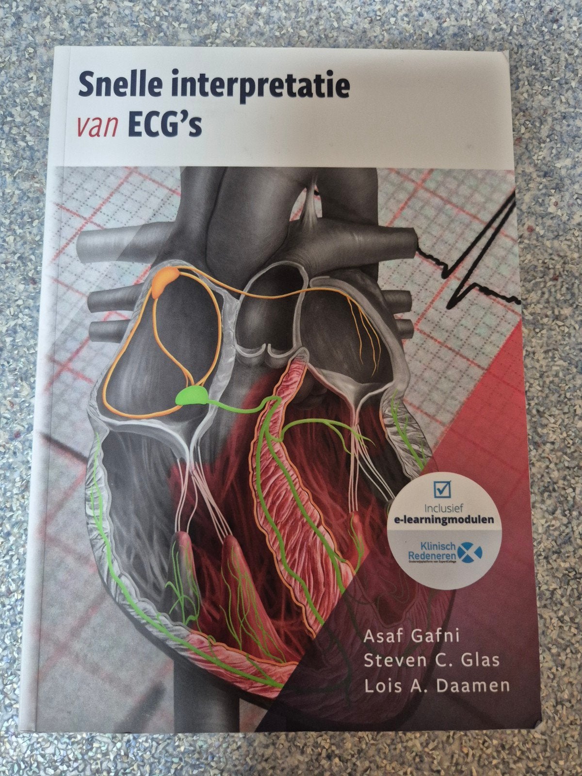 Snelle interpretatie van ECG's, Boeken, Studieboeken en Cursussen, Ophalen, Beta, Zo goed als nieuw, HBO