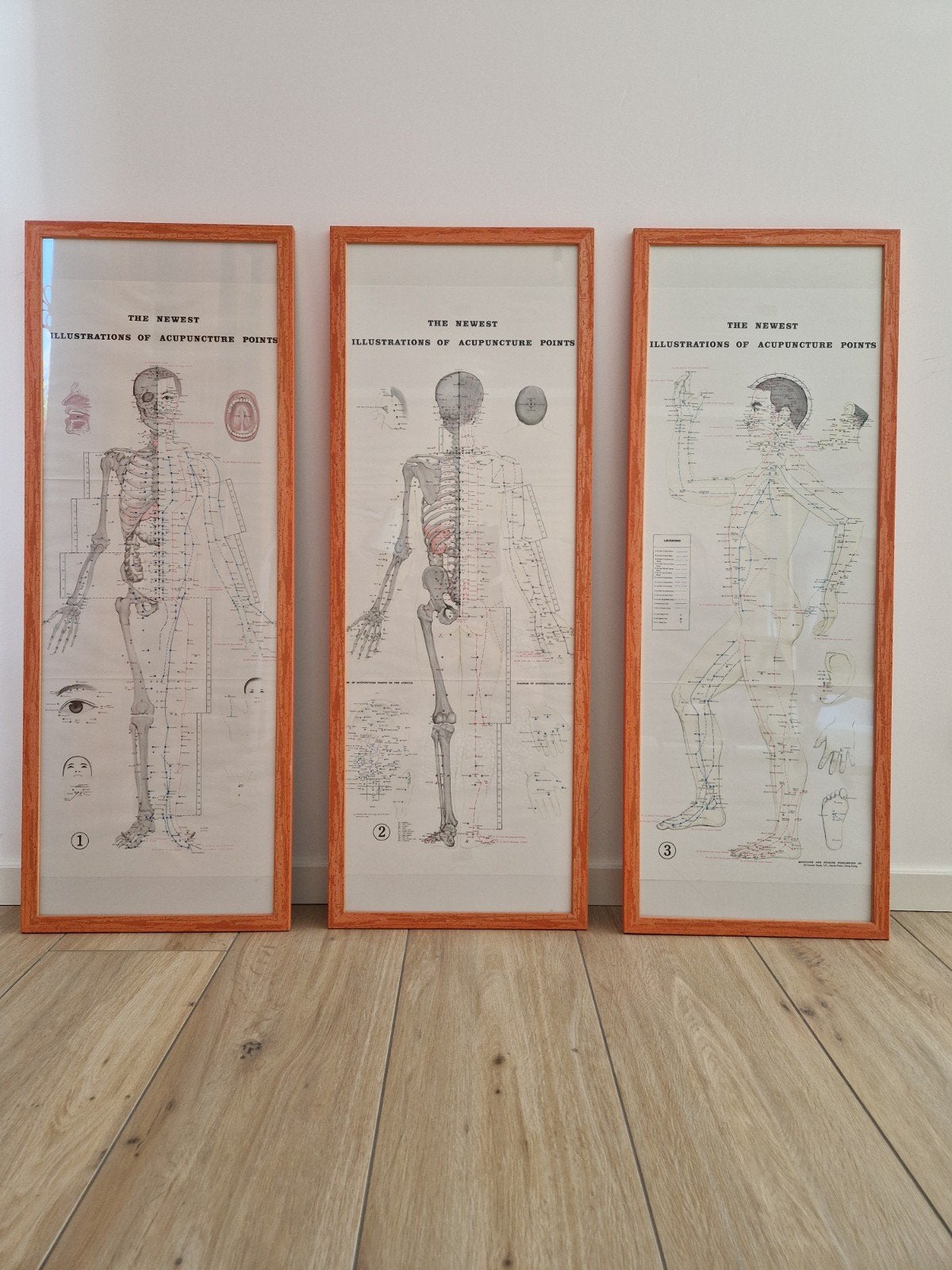 3 ingelijste posters acupunctuur met meridiaan en ap punten, Ophalen, Beta, HBO