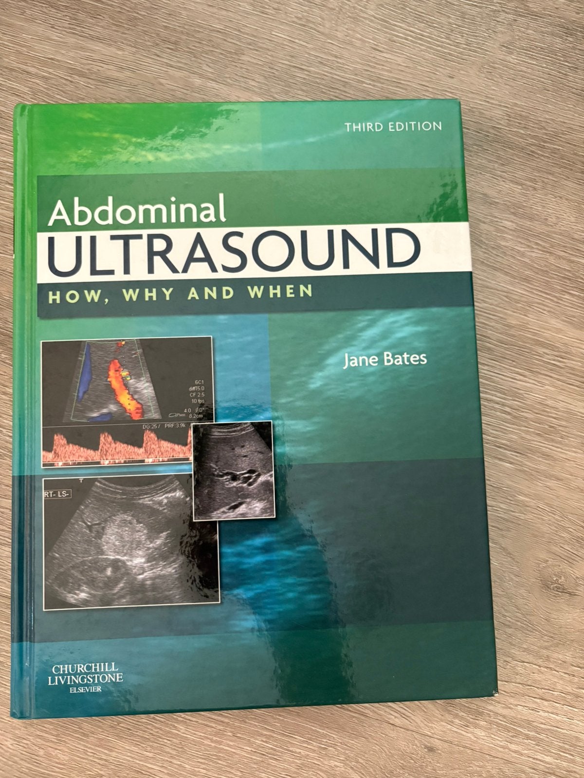Abdominal Ultrasound, druk 3, Boeken, Verzenden, Beta, Nieuw, HBO