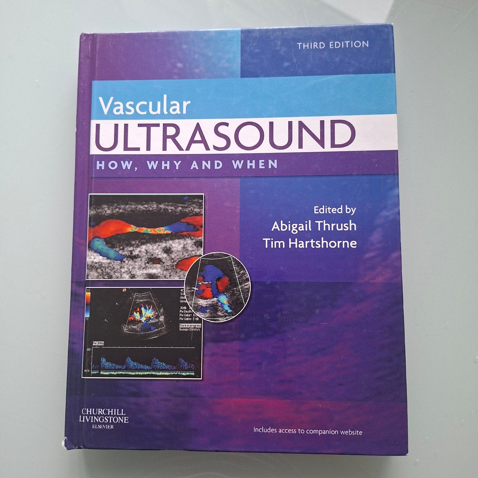 Vascular Ultrasound: How, Why and When (3e editie), Zo goed als nieuw, Abigail Thrush, Tim Hartshorne, Beta, HBO