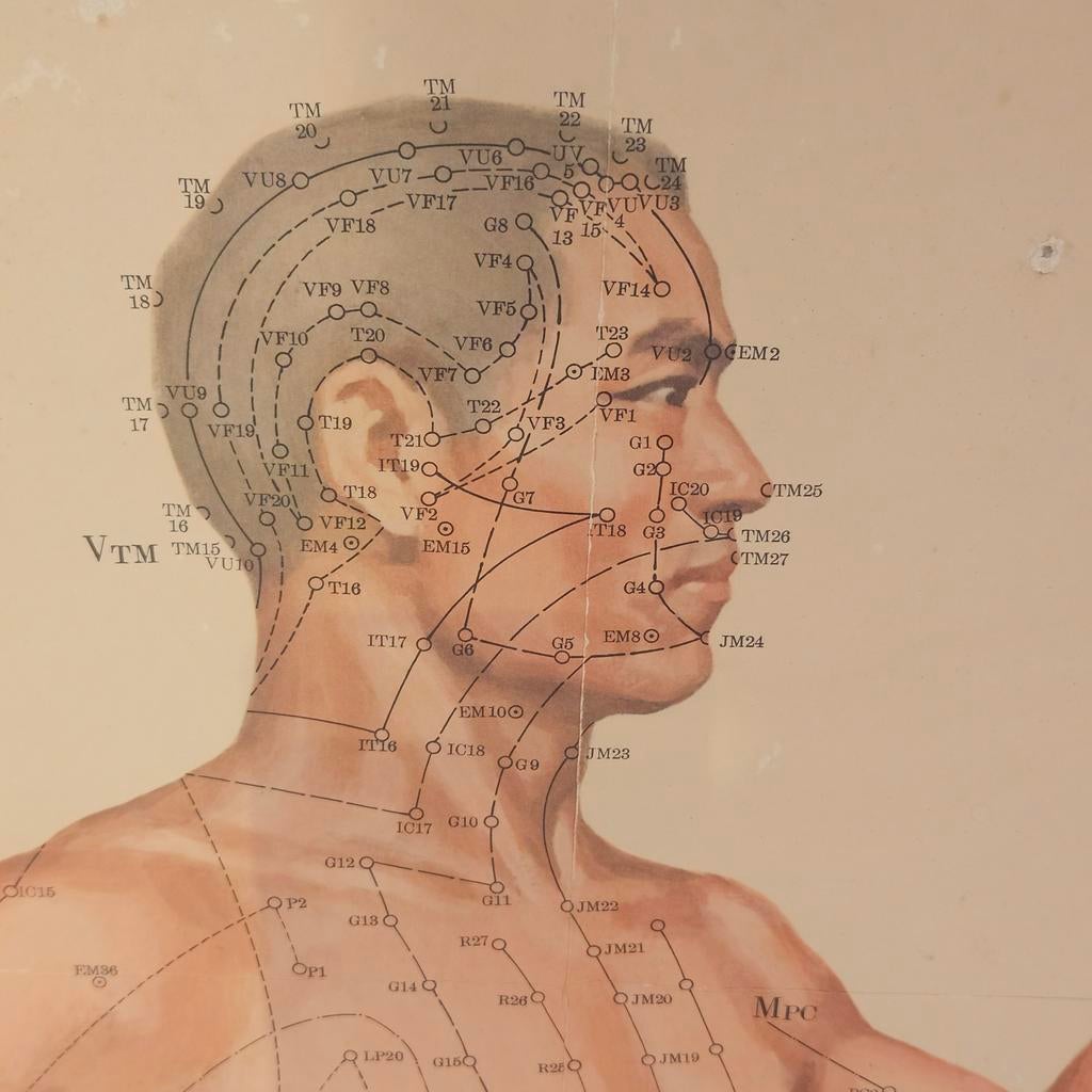 Acupuncture kaart, Ophalen of Verzenden