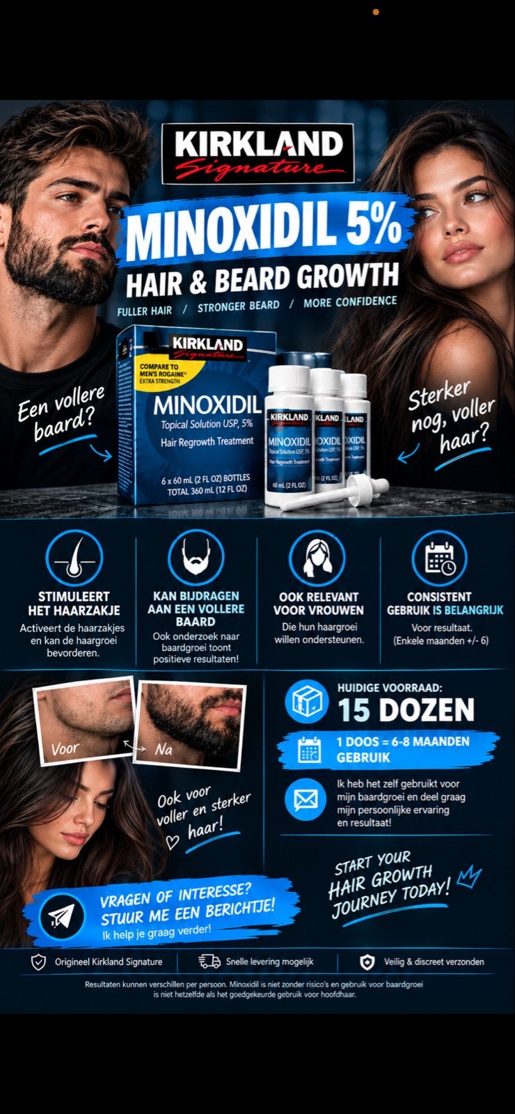 Kirkland Signature Minoxidil 5% Haar- en Baardgroei, Ophalen of Verzenden, Nieuw, Haarverzorger of -hersteller