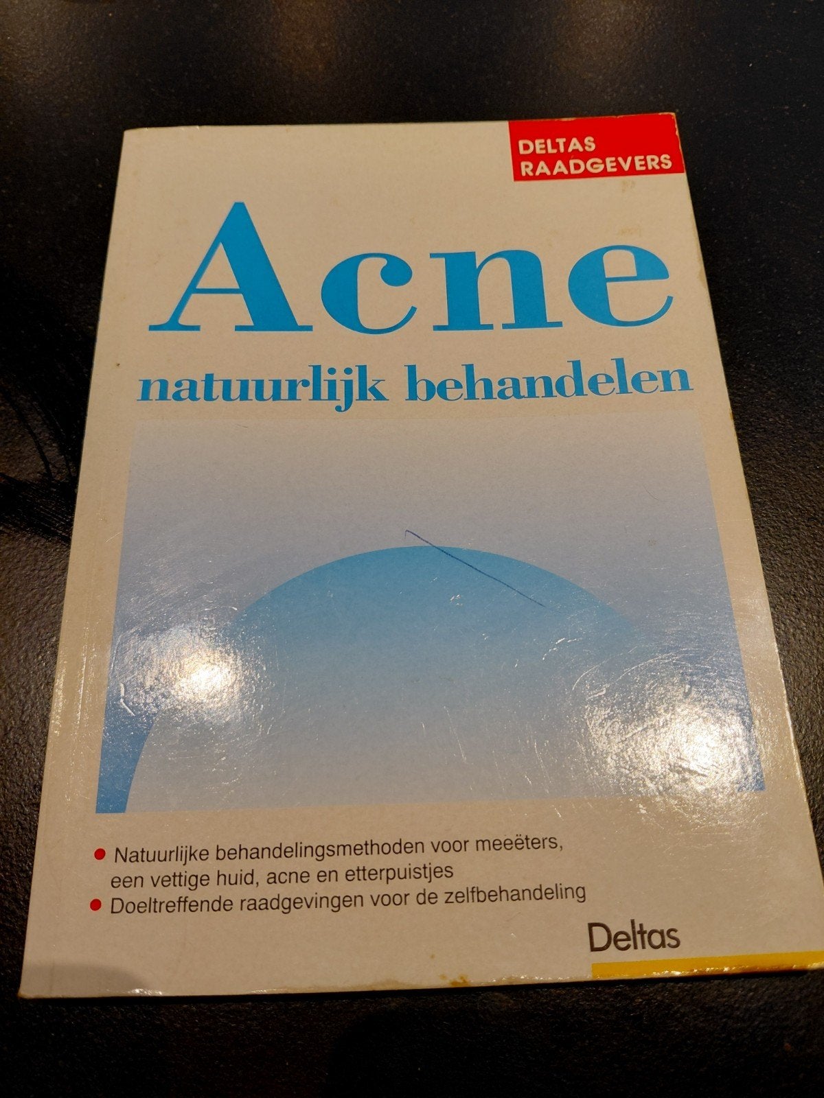 Acne natuurlijk behandelen, Ophalen of Verzenden, Gelezen, Gezondheid en Conditie, Onbekend