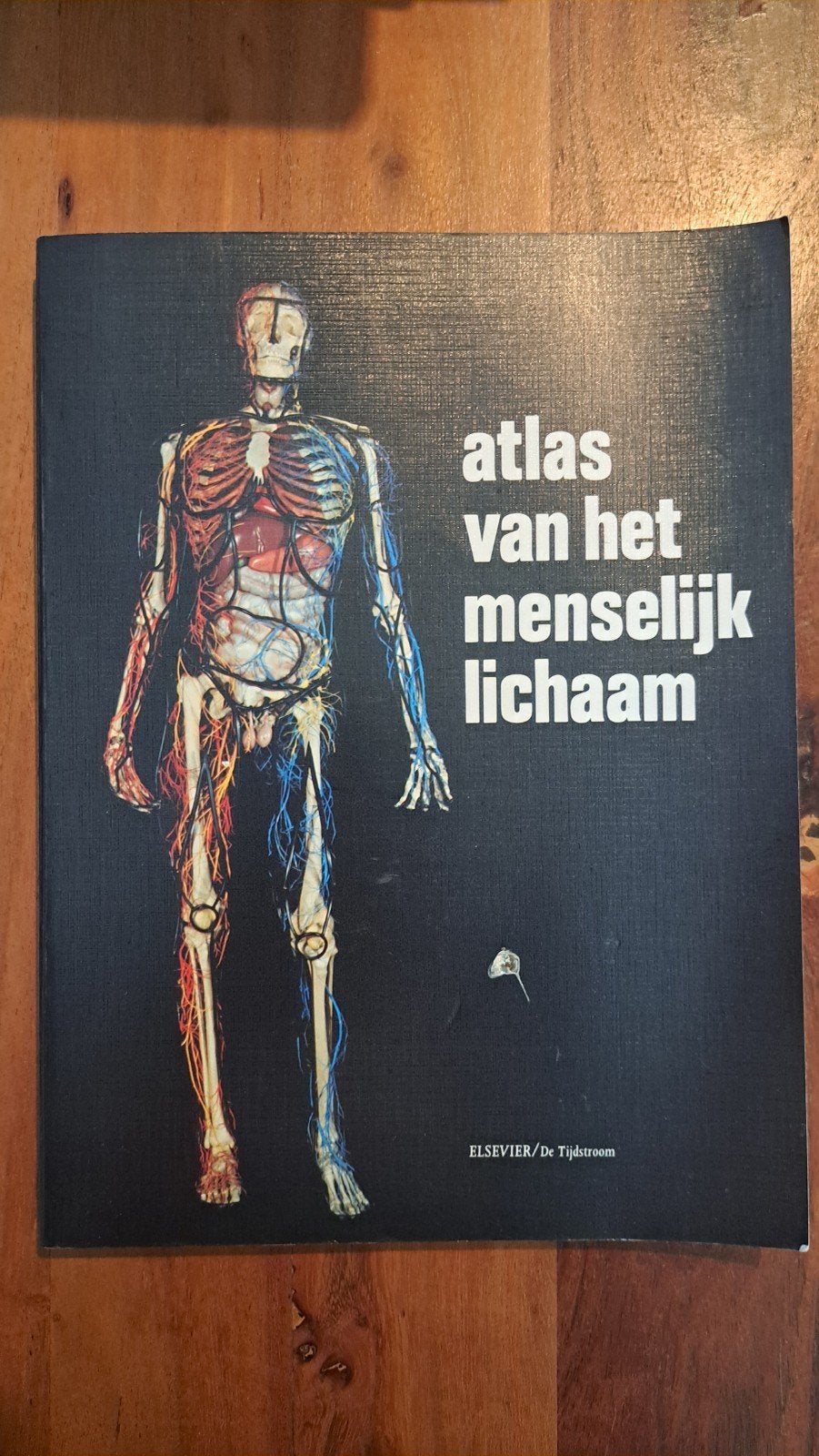 Atlas van het Menselijk Lichaam - Elsevier/De Tijdstroom, Ophalen of Verzenden, Gelezen, Onbekend, Natuurwetenschap