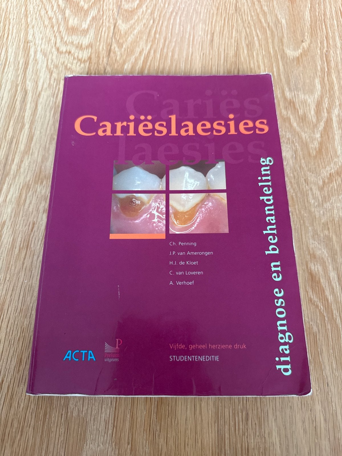 Cariëslaesies: diagnose en behandeling (Studenteneditie), Boeken, Ophalen of Verzenden, Beta, Zo goed als nieuw, WO