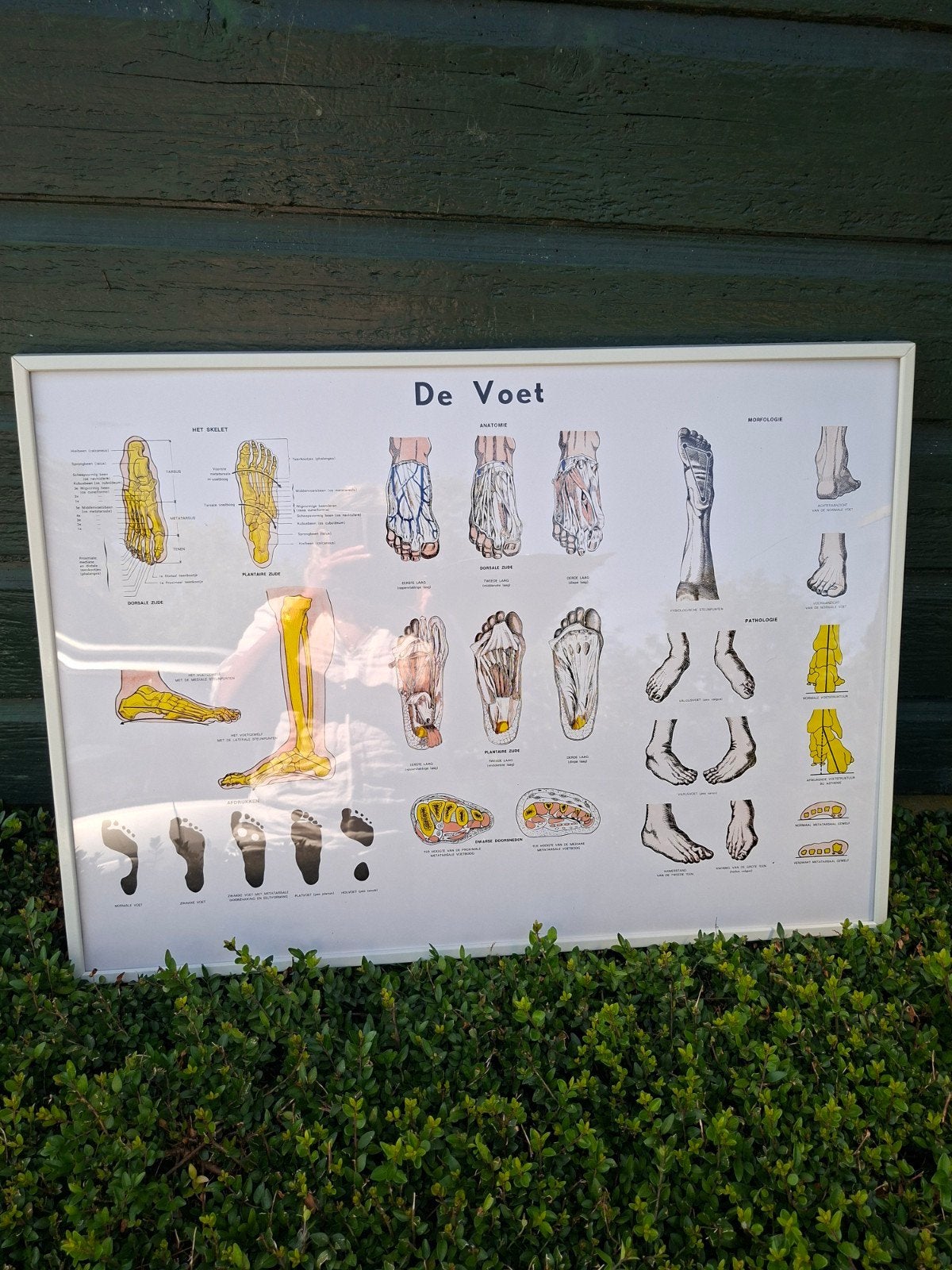 Anatomieposter Voet Ingelijst - Vintage Medische Print, Ophalen