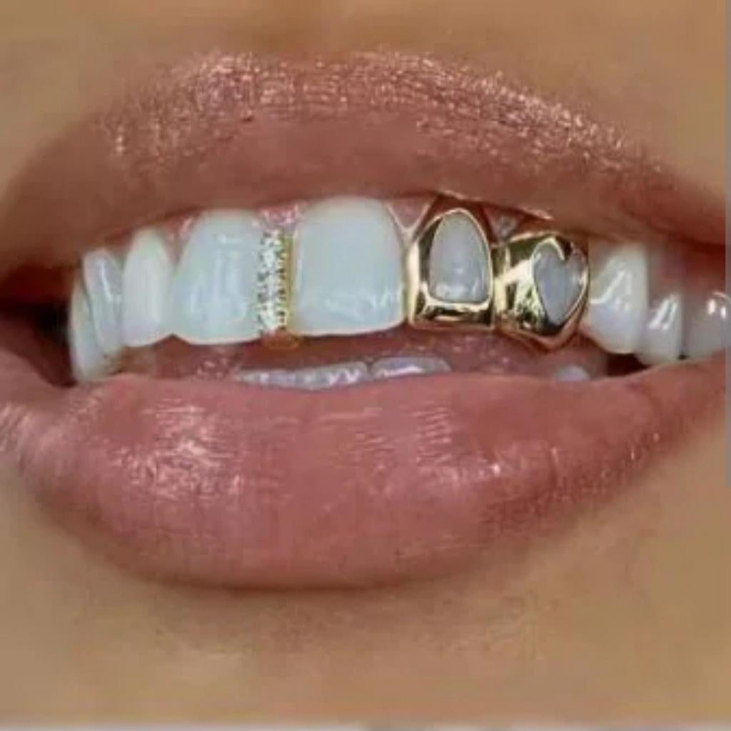 Gouden tand zetten = Grillz ' Nieuw!, Nieuw, Ophalen of Verzenden, Dame of Heer, Goud