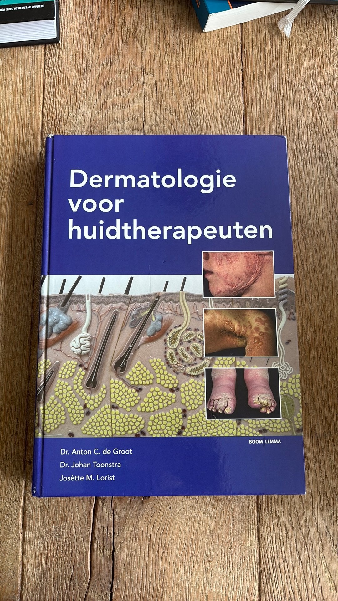 A.C. de Groot - Dermatologie voor huidtherapeuten, Sociale wetenschap, Ophalen of Verzenden, Zo goed als nieuw, A.C. de Groot; Johan Toonstra; J.M. Lorist