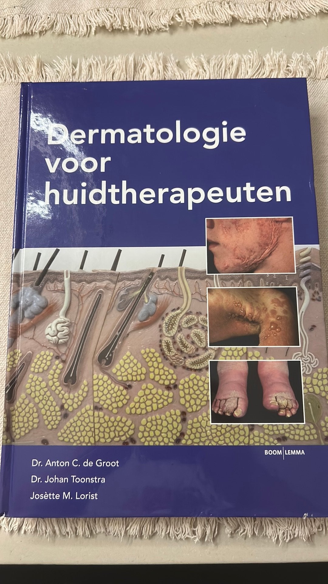 A.C. de Groot - Dermatologie voor huidtherapeuten, Gelezen, Sociale wetenschap, Ophalen of Verzenden, A.C. de Groot; Johan Toonstra; J.M. Lorist