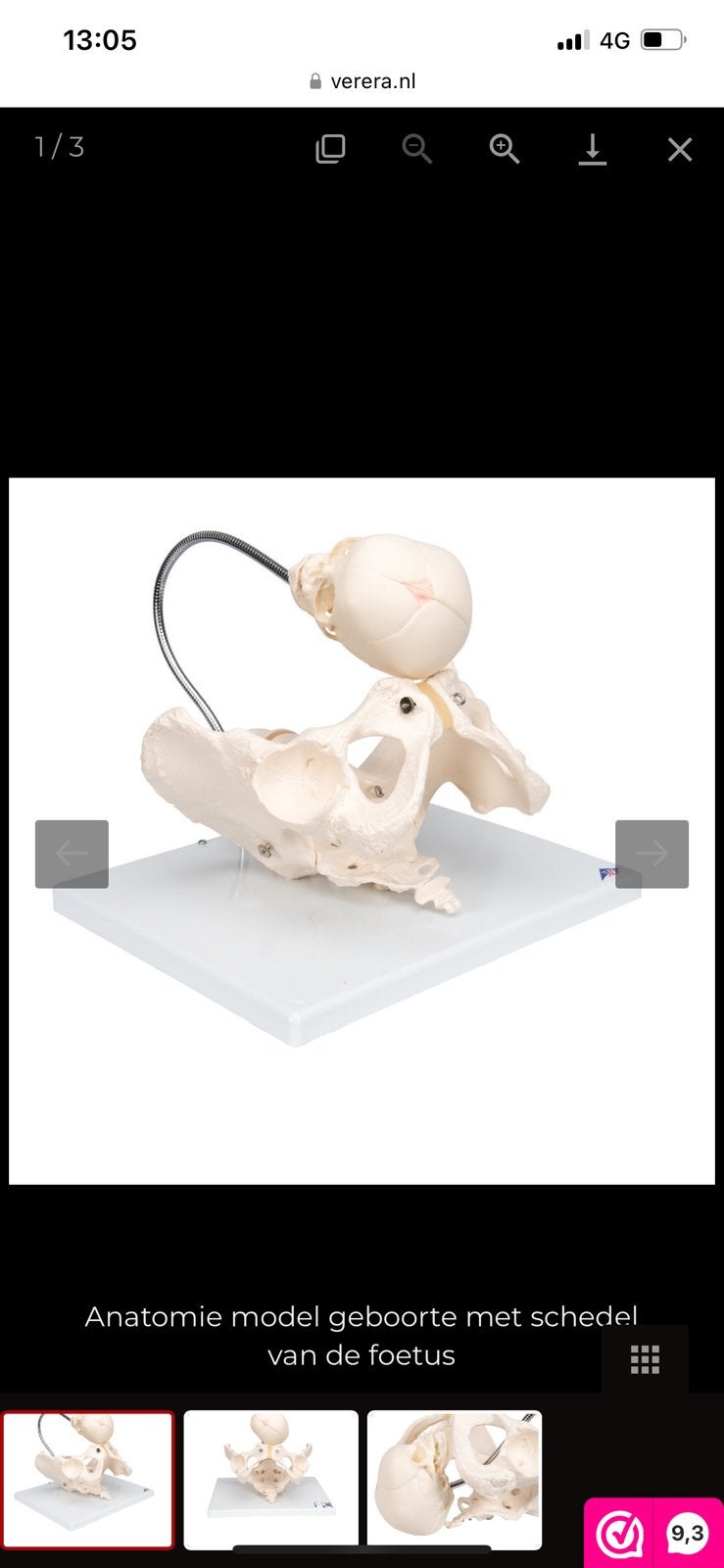 ANATOMIE MODEL GEBOORTE MET SCHEDEL VAN DE FOETUS, nieuw, Ophalen of Verzenden, Nieuw