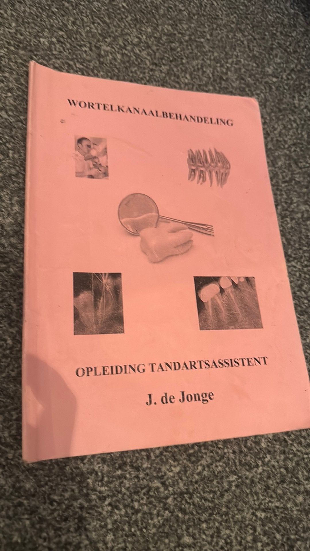 Wortelkanaalbehandeling   ISBN: 9789081698382, Ophalen of Verzenden, Beta, Gelezen, MBO