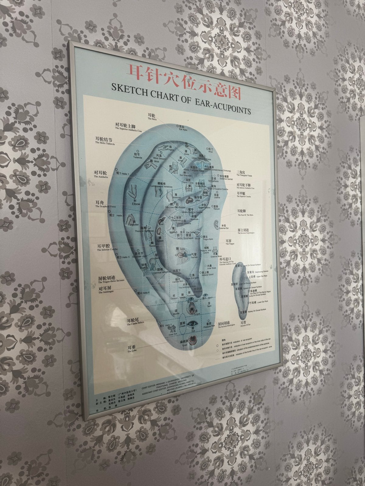 Acupunctuur Oorpunten Poster - Medische Illustratie, Met lijst, Ophalen of Verzenden, A1 t/m A3, Overige onderwerpen