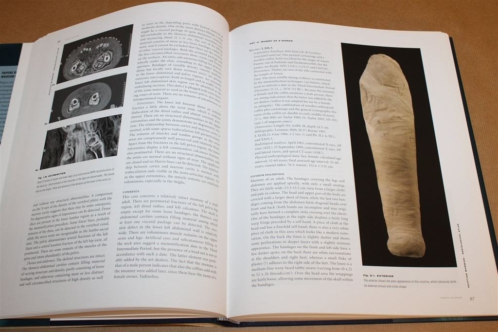 Egyptische Mummies Leiden — Radiologische Atlas [EN], Ophalen of Verzenden, Gelezen