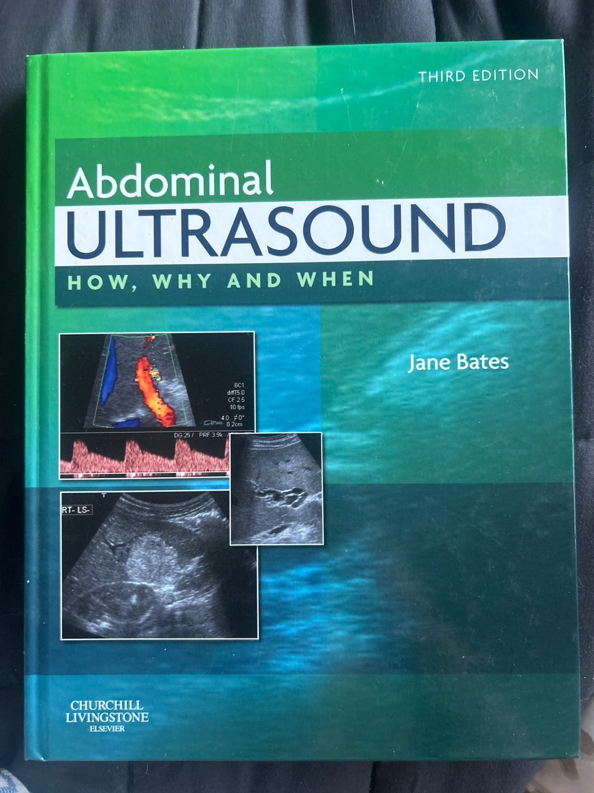 Abdominal Ultrasound: How, Why and When - Jane Bates, Ophalen of Verzenden, Beta, Zo goed als nieuw, HBO