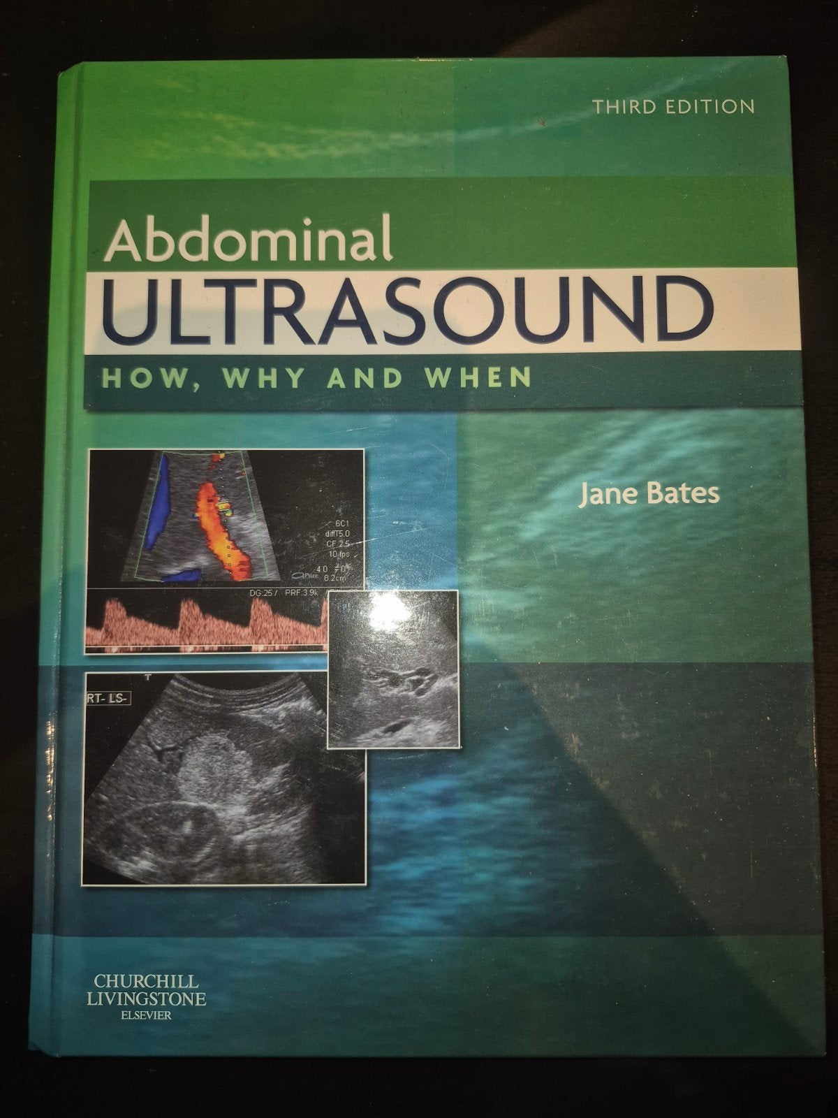 Abdominal Ultrasound: How, Why and When - Jane Bates, Boeken, Verzenden, Jane Bates, HBO, Zo goed als nieuw