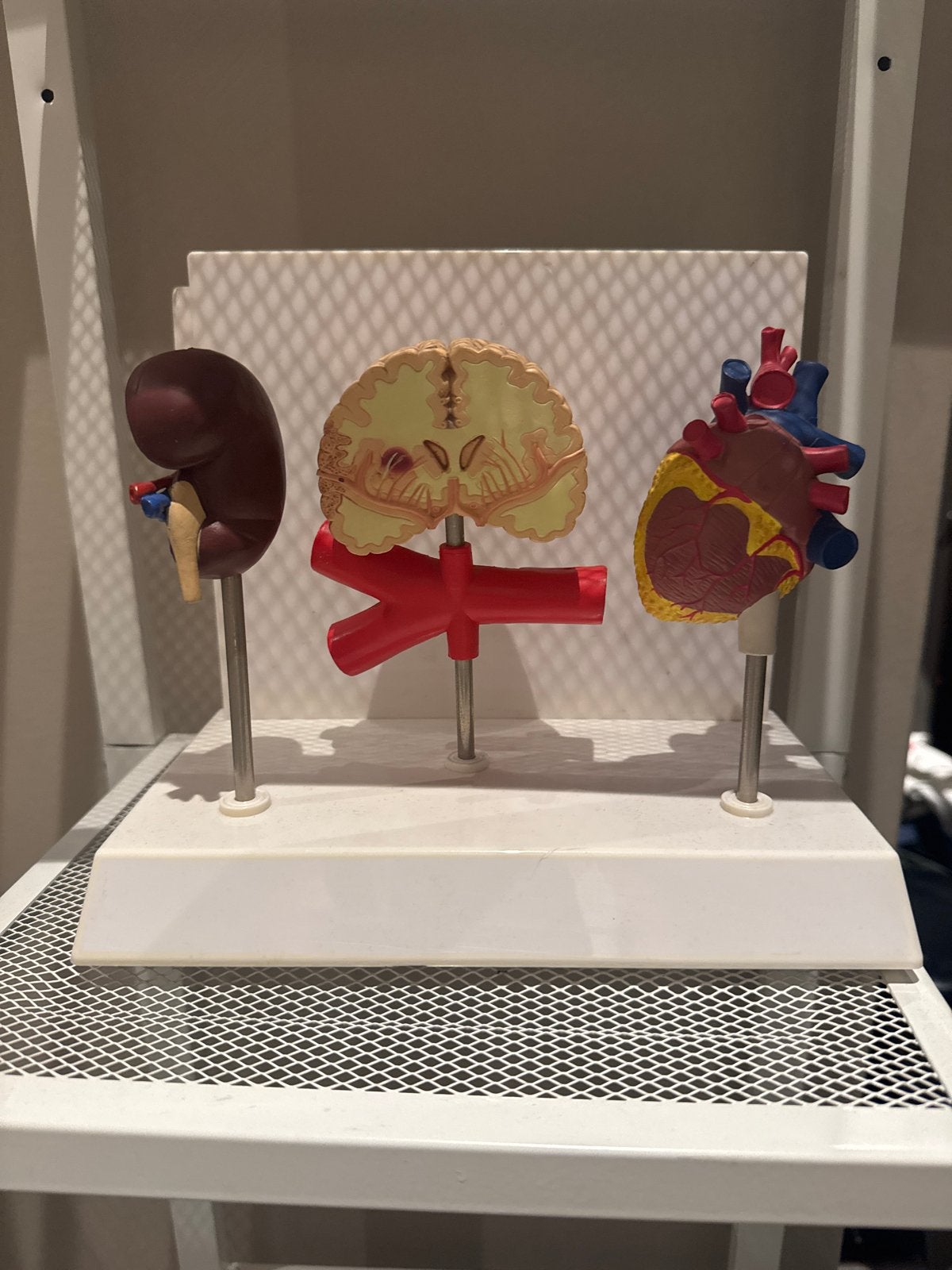 Anatomische modellen: nier, hersenen en hart, Ophalen, Gebruikt, Overige thema's, Overige typen