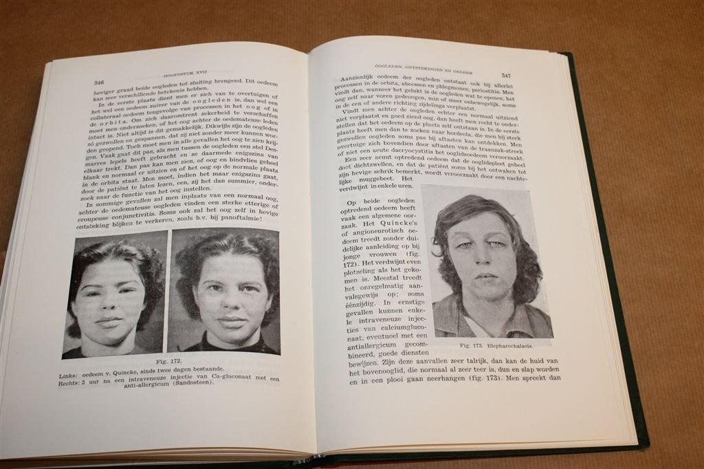 Oogheelkunde voor Algemene Arts — Vintage Medisch Boek 1964, Boeken, Ophalen of Verzenden, Gelezen