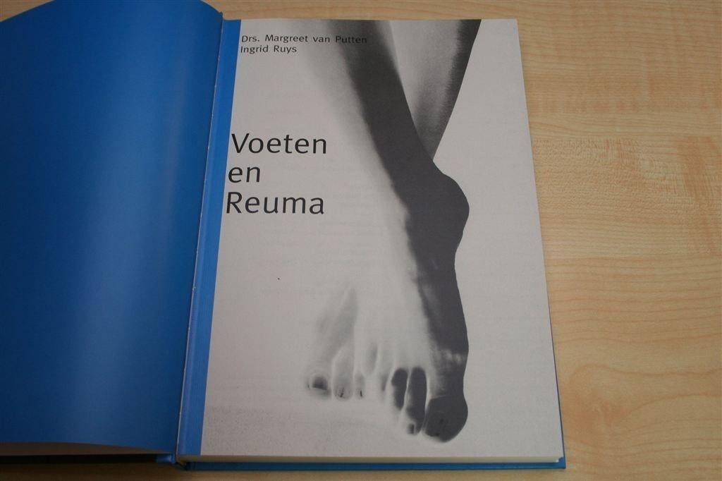 Voeten en Reuma — Uitgebreide Gids met Veel Illustraties, Ophalen of Verzenden, Zo goed als nieuw
