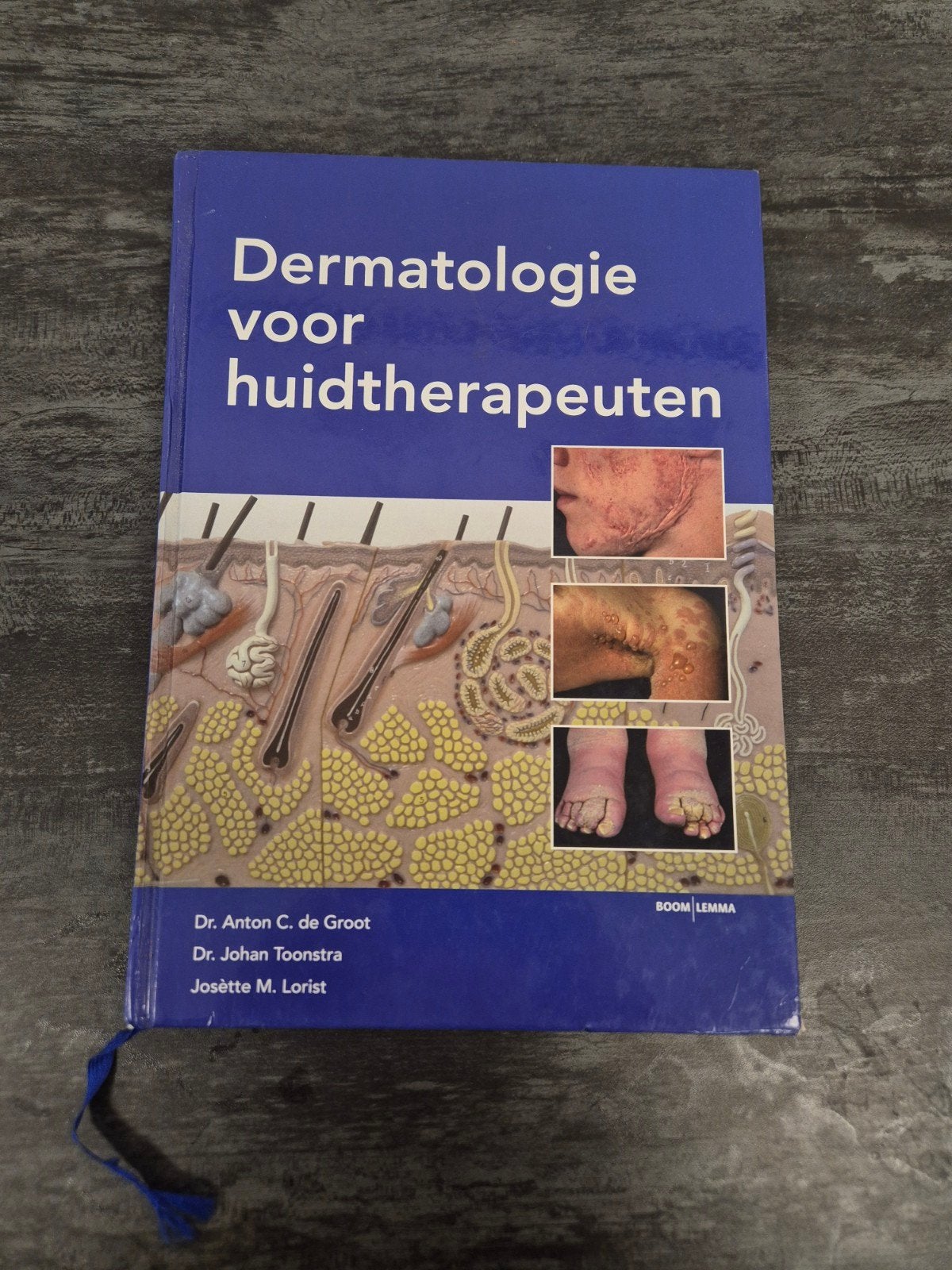 Dermatologie voor huidtherapeuten - Studieboek, Gelezen, Dr. Anton C. de Groot, Dr. Johan Toonstra, Josètte M. Lorist, Beta, HBO